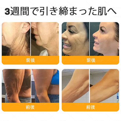 🎁🎁 𝑽𝑳𝑺𝑽𝑳𝑺® ラストチャンス！この幸運の宝物を、70%OFFで手に入れましょう！