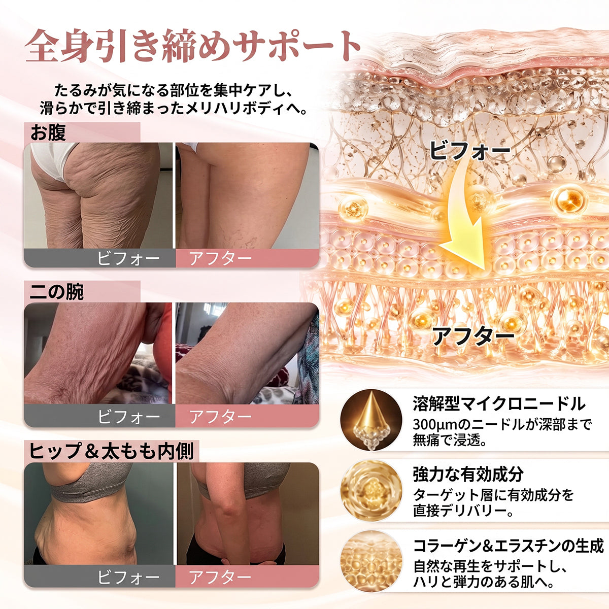 🎁🎁🎁 HISKIN® 最後のチャンス！幸運の特別オファーを70％OFFでお見逃しなく！
